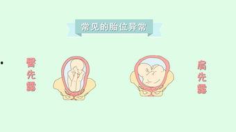 摸胎位视频,通过摸胎位视频揭示孕期胎儿位置奥秘